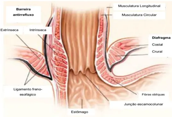 Refluxo gastro esofágico (RGE)